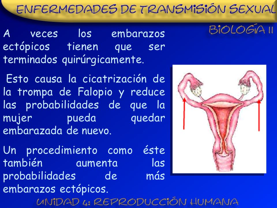 A veces los embarazos ectópicos tienen que ser terminados quirúrgicamente.