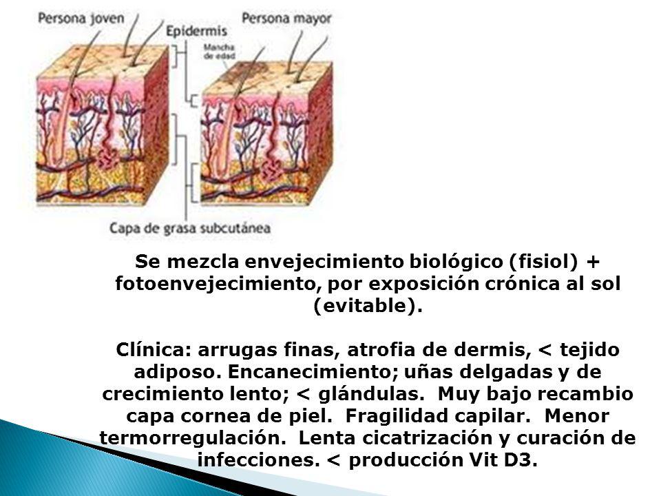 Se mezcla envejecimiento biológico (fisiol) + fotoenvejecimiento, por exposición crónica al sol (evitable).