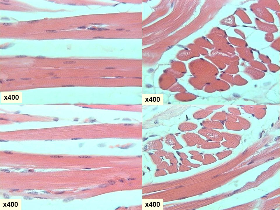 x400 x400 x400 x400