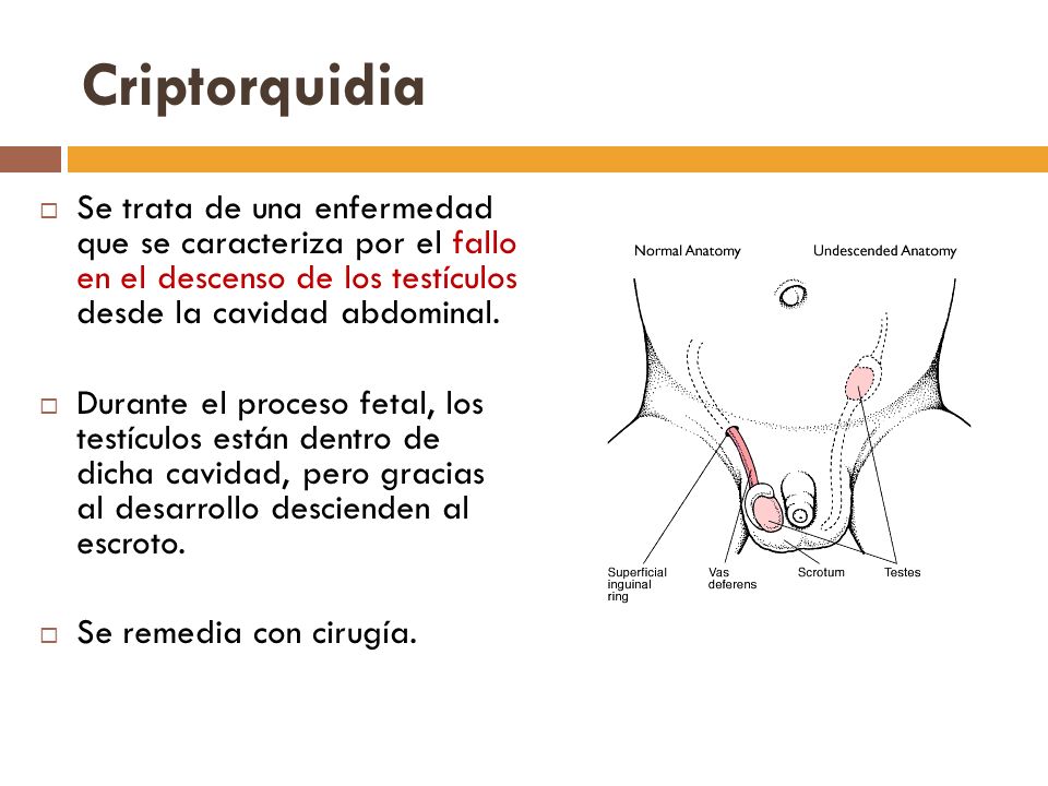 Criptorquidia Se trata de una enfermedad que se caracteriza por el fallo en el descenso de los testículos desde la cavidad abdominal.
