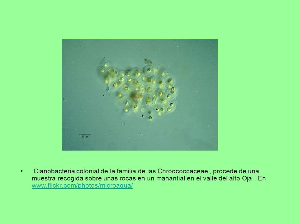 Cianobacteria colonial de la familia de las Chroococcaceae , procede de una muestra recogida sobre unas rocas en un manantial en el valle del alto Oja .