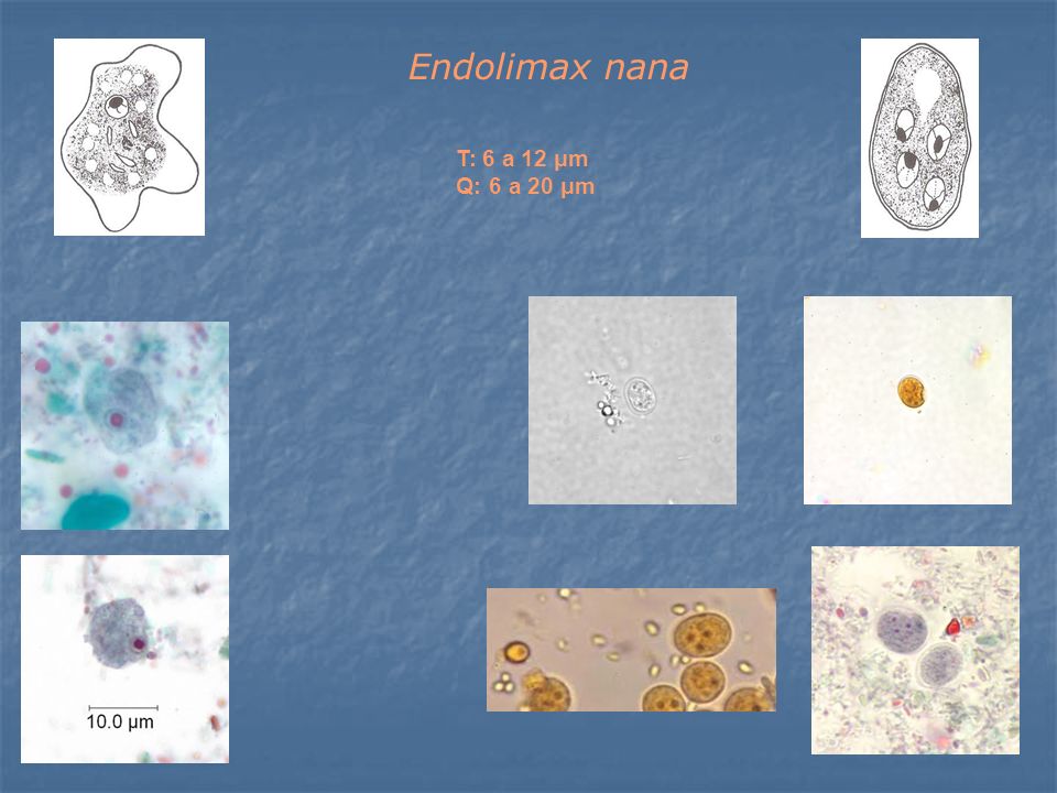 Endolimax nana T: 6 a 12 μm Q: 6 a 20 μm