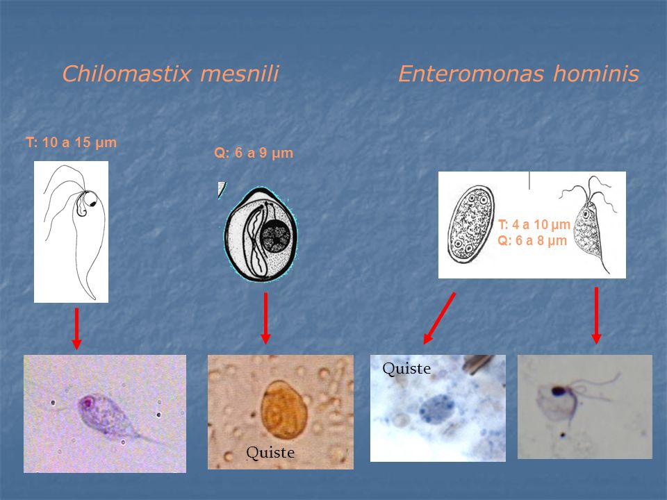 Chilomastix mesnili Enteromonas hominis Quiste Quiste T: 10 a 15 μm