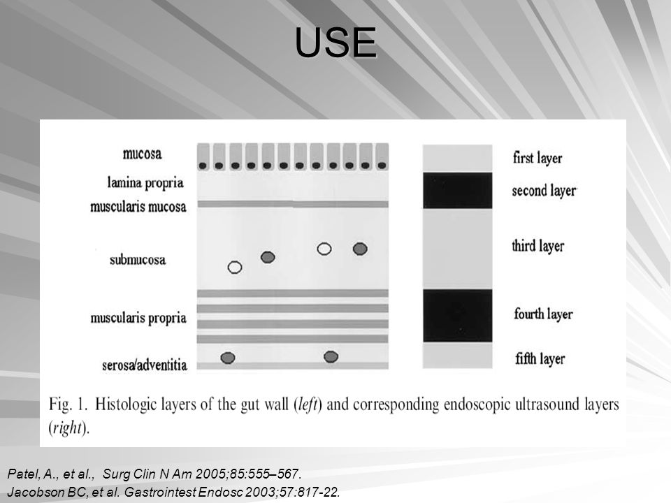 USE Patel, A., et al., Surg Clin N Am 2005;85:555–567.
