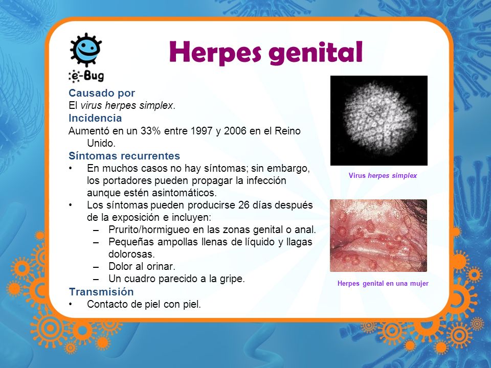 Herpes genital en una mujer