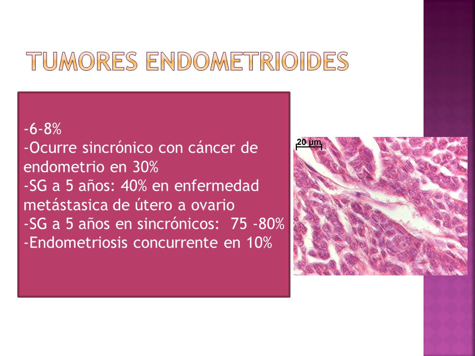 Tumores endometrioides