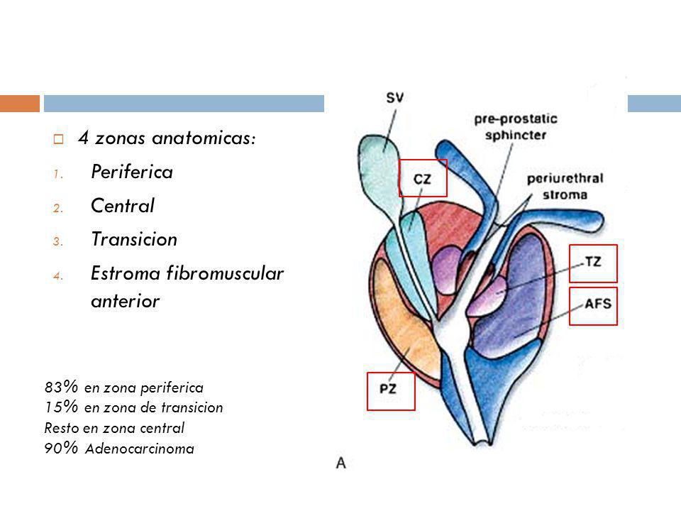 Estroma fibromuscular anterior
