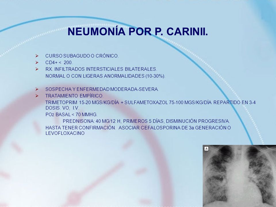 NEUMONÍA POR P. CARINII. CURSO SUBAGUDO O CRÓNICO. CD4+ < 200.