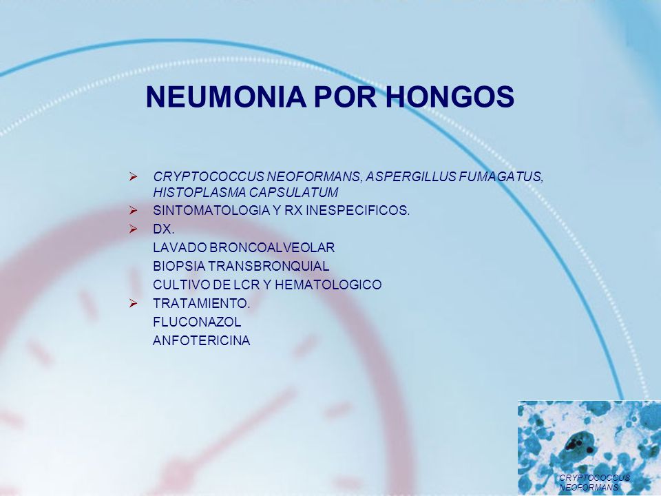 NEUMONIA POR HONGOS CRYPTOCOCCUS NEOFORMANS, ASPERGILLUS FUMAGATUS, HISTOPLASMA CAPSULATUM. SINTOMATOLOGIA Y RX INESPECIFICOS.