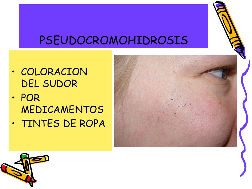 PSEUDOCROMOHIDROSIS COLORACION DEL SUDOR POR MEDICAMENTOS