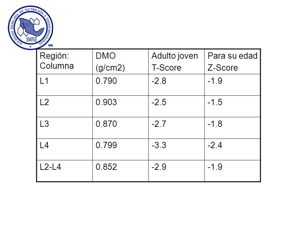 Región: Columna DMO. (g/cm2) Adulto joven. T-Score. Para su edad. Z-Score. L