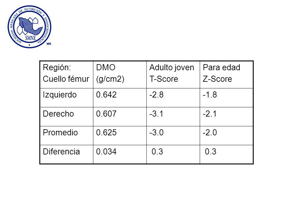 Región: Cuello fémur. DMO. (g/cm2) Adulto joven. T-Score. Para edad. Z-Score. Izquierdo