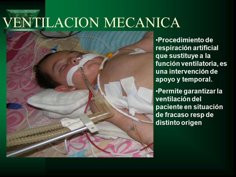 VENTILACION MECANICA Procedimiento de respiración artificial que sustituye a la función ventilatoria, es una intervención de apoyo y temporal.