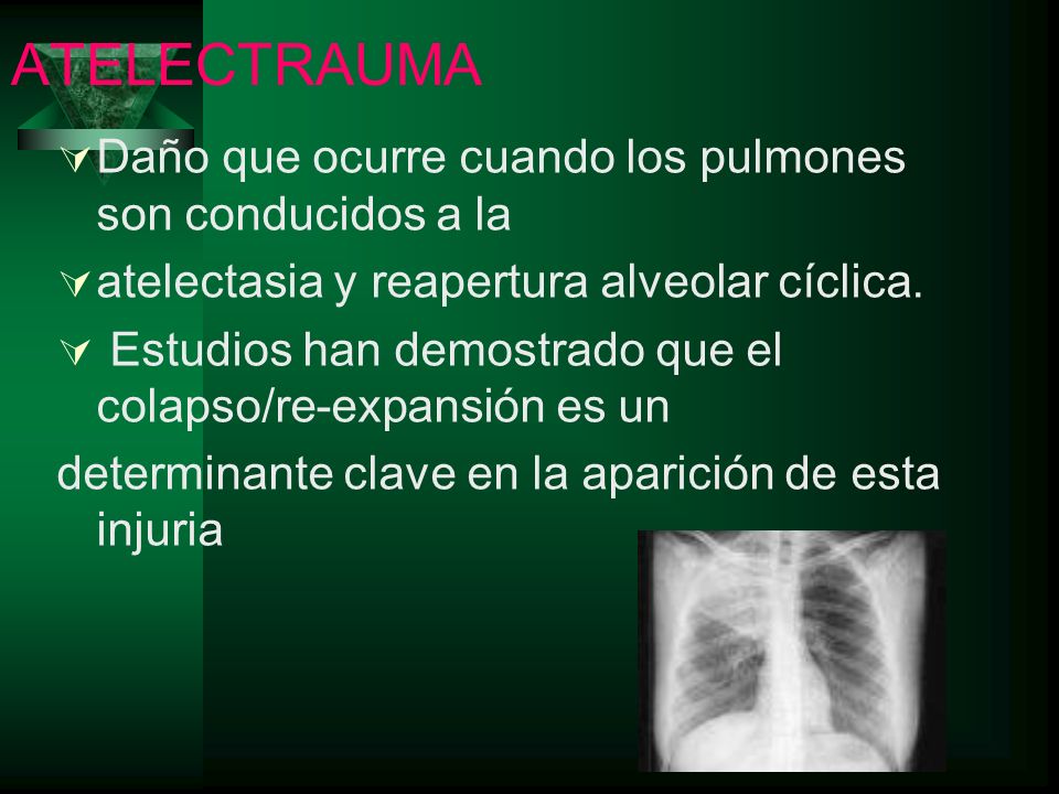 ATELECTRAUMA Daño que ocurre cuando los pulmones son conducidos a la