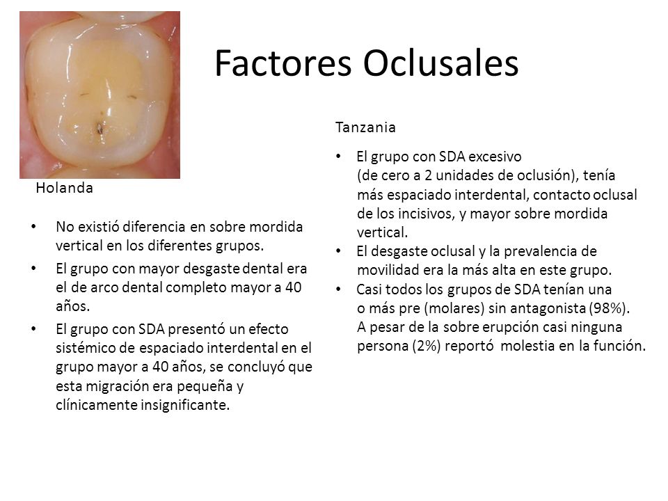 Factores Oclusales Tanzania Holanda El grupo con SDA excesivo