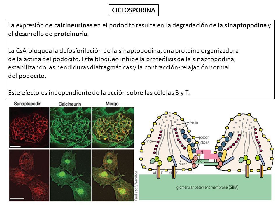 CICLOSPORINA La expresión de calcineurinas en el podocito resulta en la degradación de la sinaptopodina y el desarrollo de proteinuria.