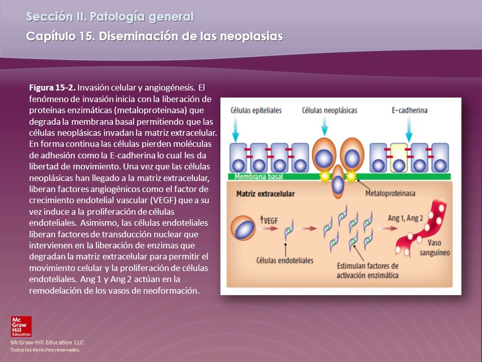 Figura Invasión celular y angiogénesis