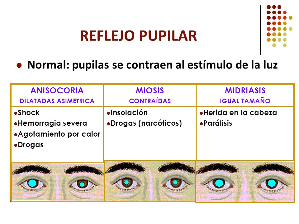 REFLEJO PUPILAR Normal: pupilas se contraen al estímulo de la luz