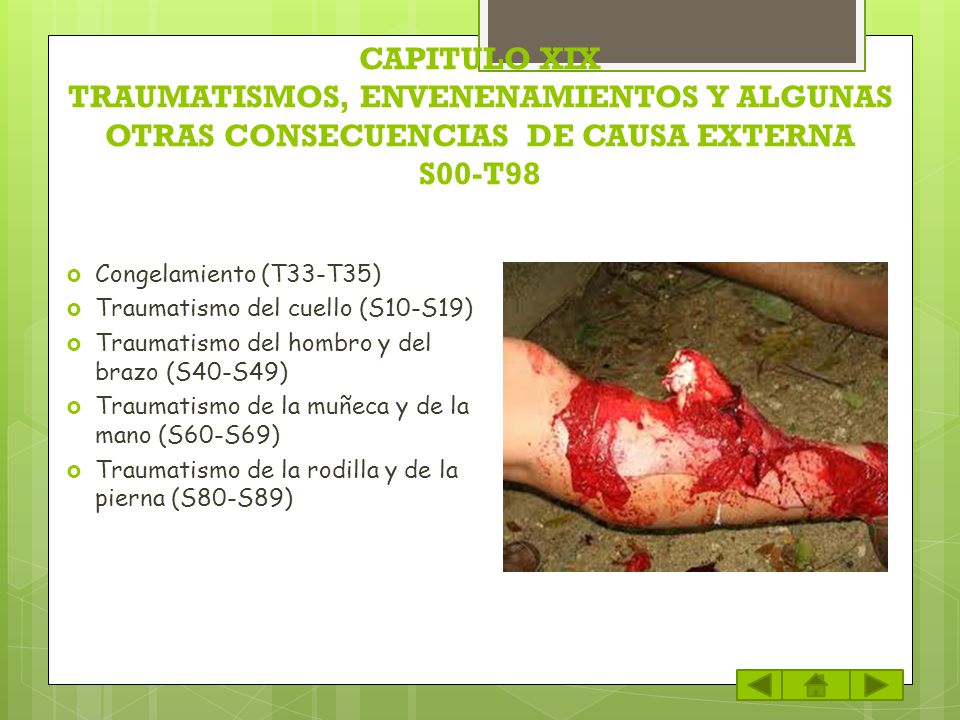 CAPITULO XIX TRAUMATISMOS, ENVENENAMIENTOS Y ALGUNAS OTRAS CONSECUENCIAS DE CAUSA EXTERNA S00-T98