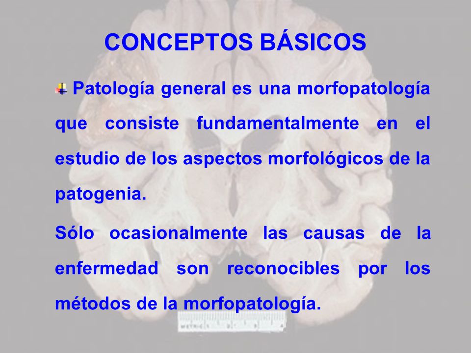 CONCEPTOS BÁSICOS Patología general es una morfopatología que consiste fundamentalmente en el estudio de los aspectos morfológicos de la patogenia.