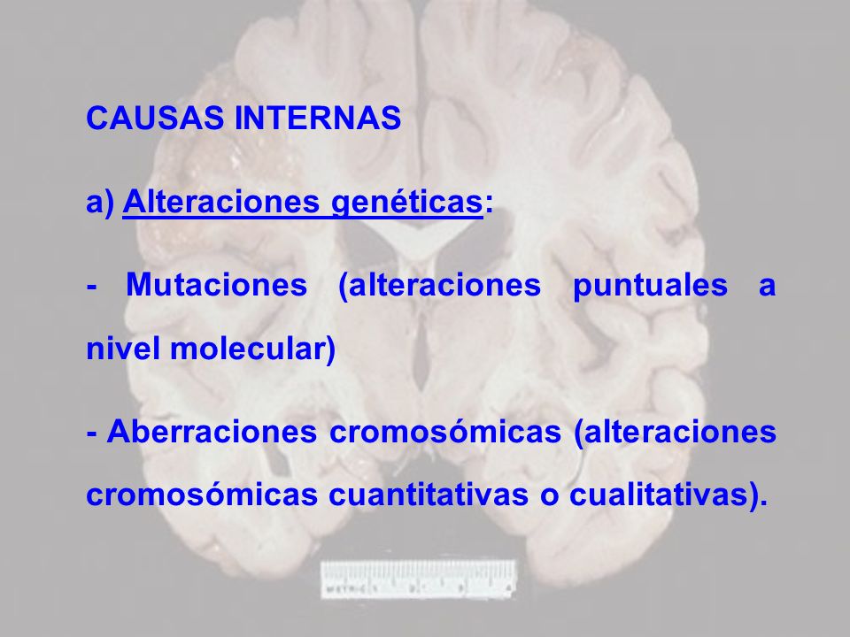 CAUSAS INTERNAS a) Alteraciones genéticas: - Mutaciones (alteraciones puntuales a nivel molecular)