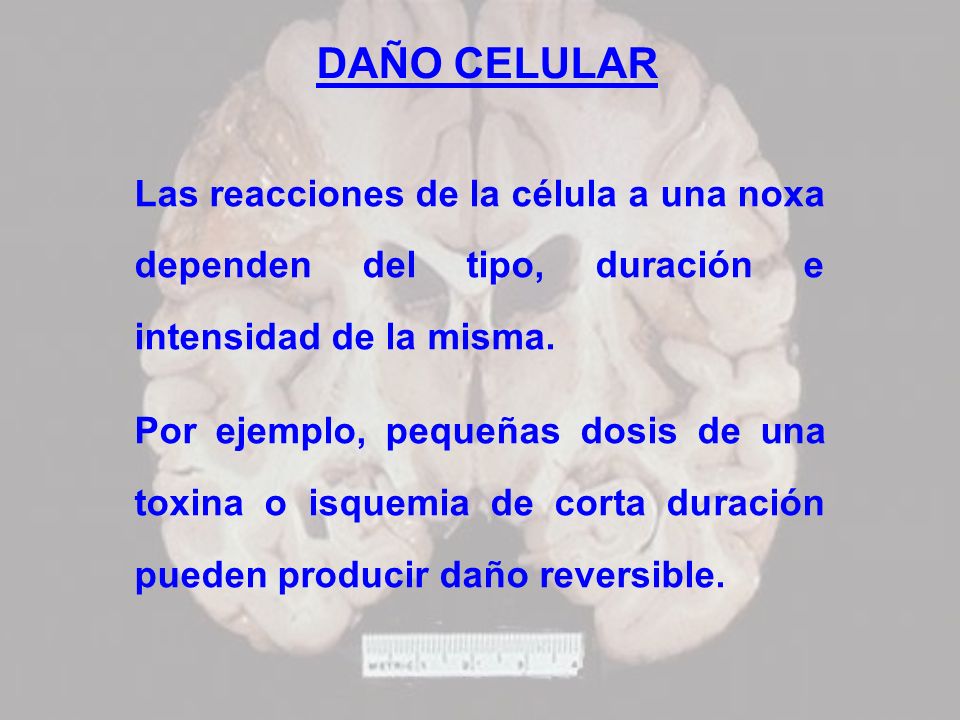 DAÑO CELULAR Las reacciones de la célula a una noxa dependen del tipo, duración e intensidad de la misma.