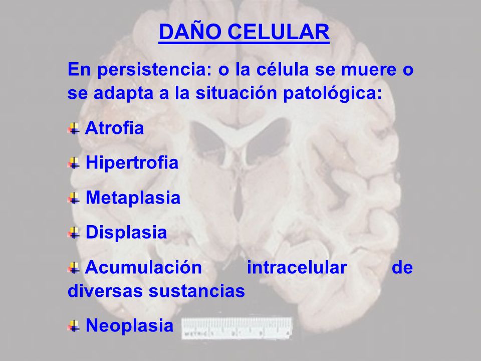 DAÑO CELULAR En persistencia: o la célula se muere o se adapta a la situación patológica: Atrofia.
