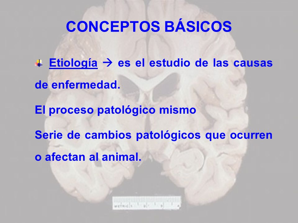 CONCEPTOS BÁSICOS Etiología  es el estudio de las causas de enfermedad. El proceso patológico mismo.