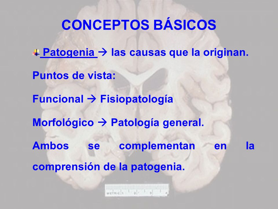 CONCEPTOS BÁSICOS Patogenia  las causas que la originan.