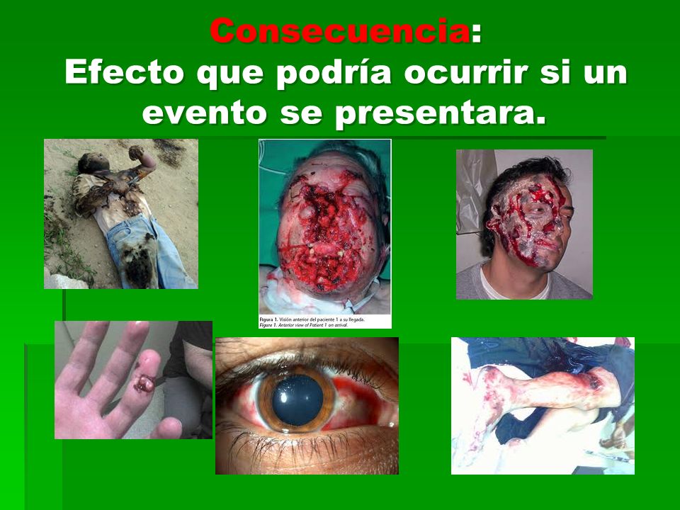 Consecuencia: Efecto que podría ocurrir si un evento se presentara.