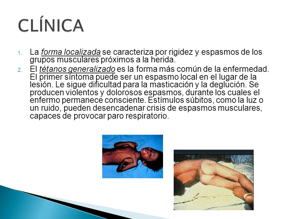 CLÍNICA La forma localizada se caracteriza por rigidez y espasmos de los grupos musculares próximos a la herida.