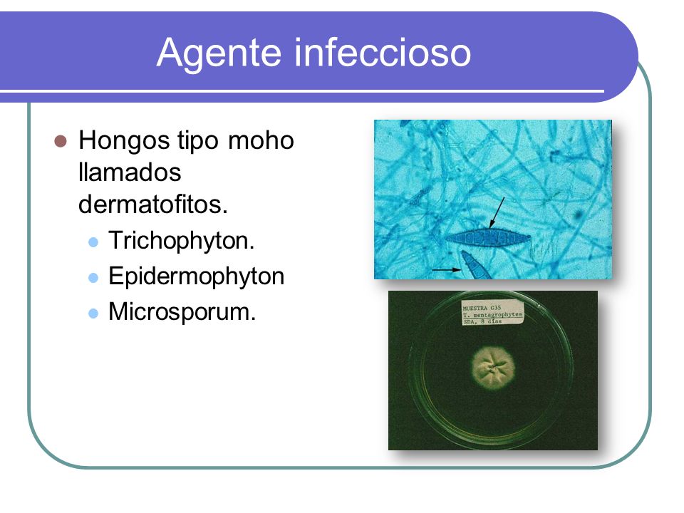 Agente infeccioso Hongos tipo moho llamados dermatofitos.