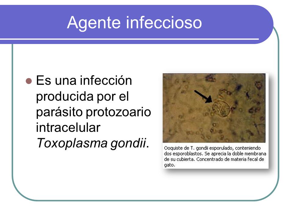 Agente infeccioso Es una infección producida por el parásito protozoario intracelular Toxoplasma gondii.