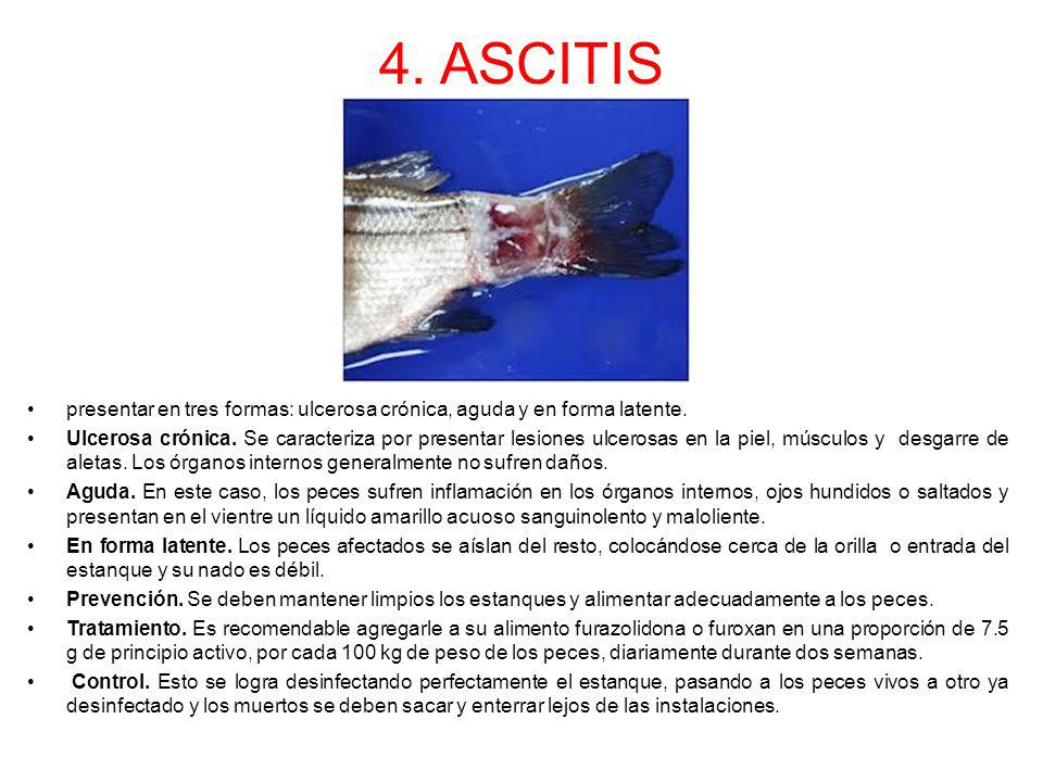 4. ASCITIS presentar en tres formas: ulcerosa crónica, aguda y en forma latente.