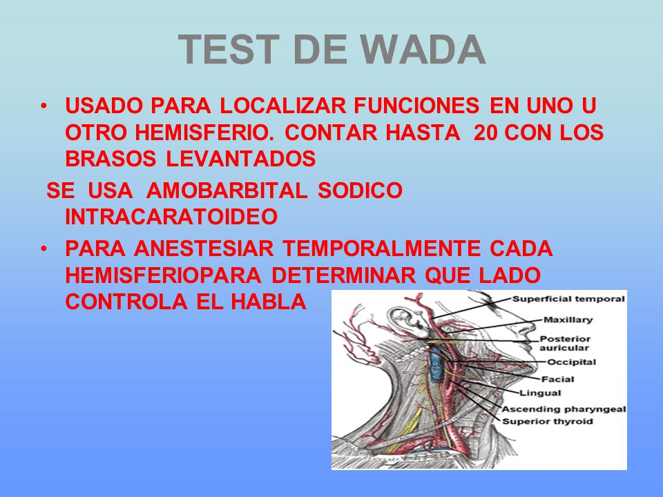 TEST DE WADA USADO PARA LOCALIZAR FUNCIONES EN UNO U OTRO HEMISFERIO. CONTAR HASTA 20 CON LOS BRASOS LEVANTADOS.
