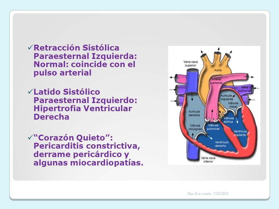 Retracción Sistólica Paraesternal Izquierda: Normal: coincide con el pulso arterial