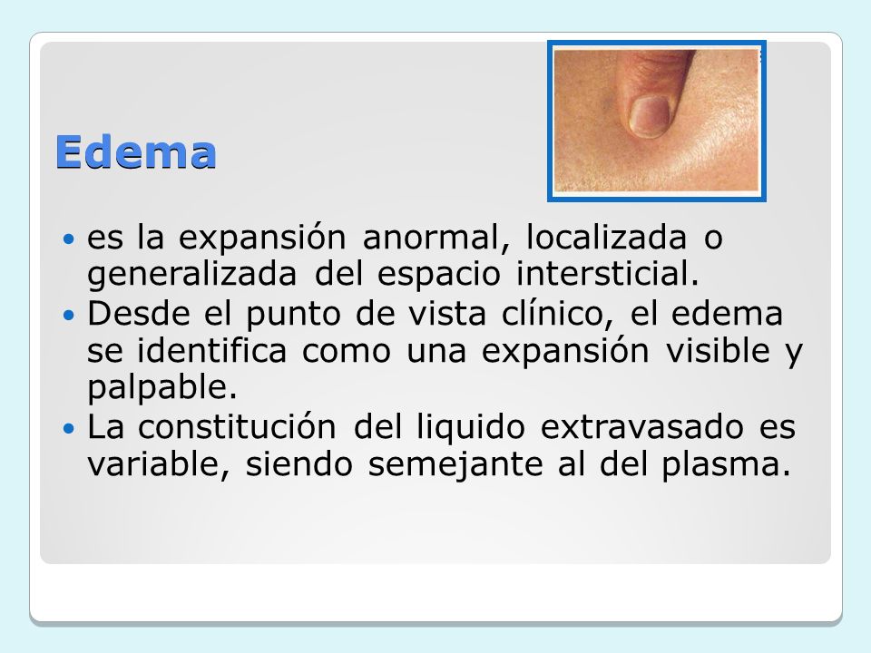Edema es la expansión anormal, localizada o generalizada del espacio intersticial.