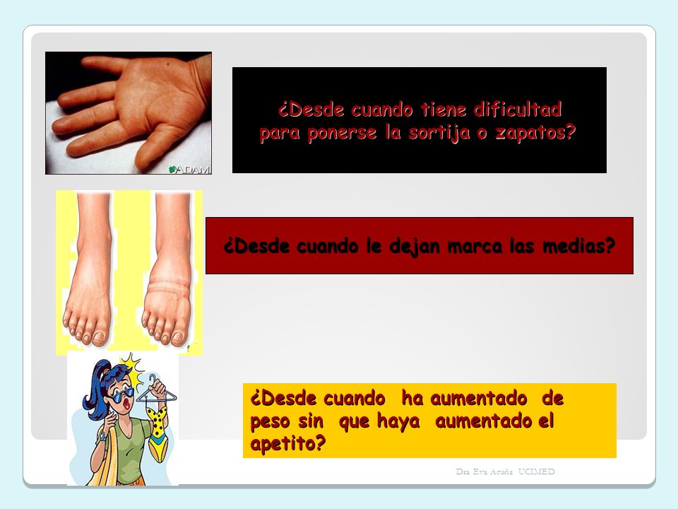 ¿Desde cuando tiene dificultad para ponerse la sortija o zapatos