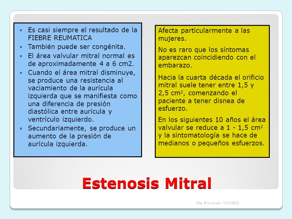 Estenosis Mitral Es casi siempre el resultado de la FIEBRE REUMATICA