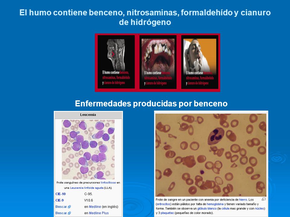 El humo contiene benceno, nitrosaminas, formaldehído y cianuro de hidrógeno