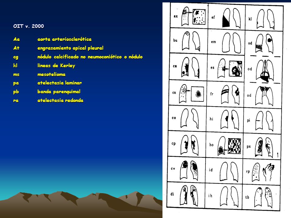 OIT v Aa aorta arteriosclerótica. At engrasamiento apical pleural. cg nódulo calcificado no neumoconiótico o nódulo.