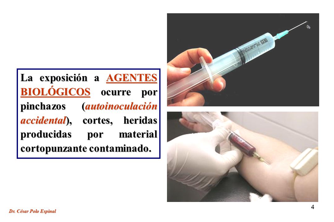 La exposición a AGENTES BIOLÓGICOS ocurre por pinchazos (autoinoculación accidental), cortes, heridas producidas por material cortopunzante contaminado.