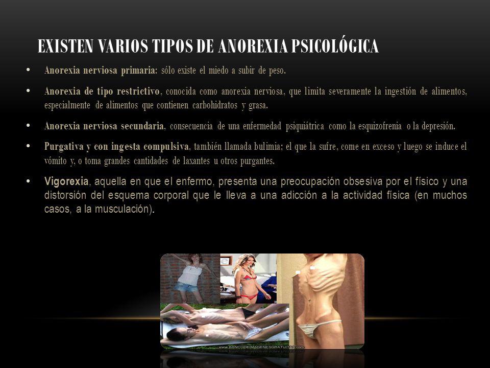 Existen varios tipos de anorexia psicológica