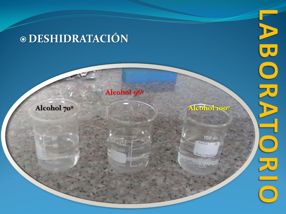 laboratorio DESHIDRATACIÓN Alcohol 96º Alcohol 70º Alcohol 100º