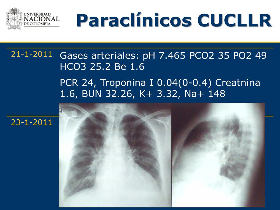 Paraclínicos CUCLLR Gases arteriales: pH PCO2 35 PO2 49 HCO Be 1.6.
