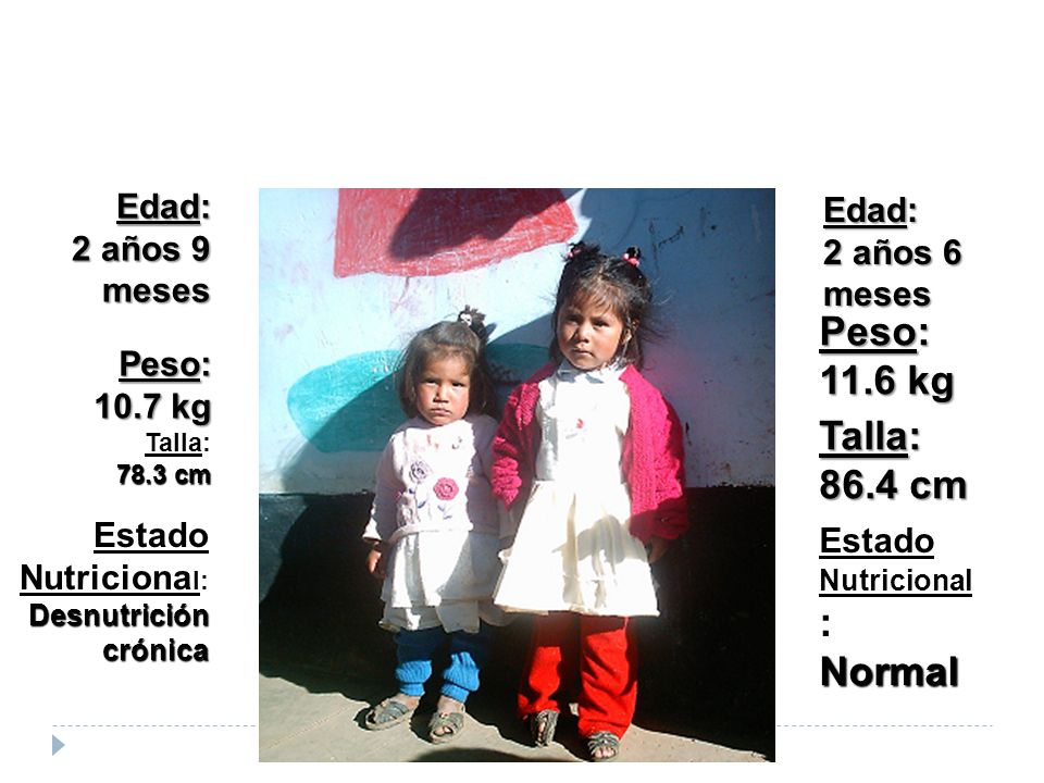 Peso: 11.6 kg Talla: 86.4 cm Normal Edad: 2 años 9 meses Edad: