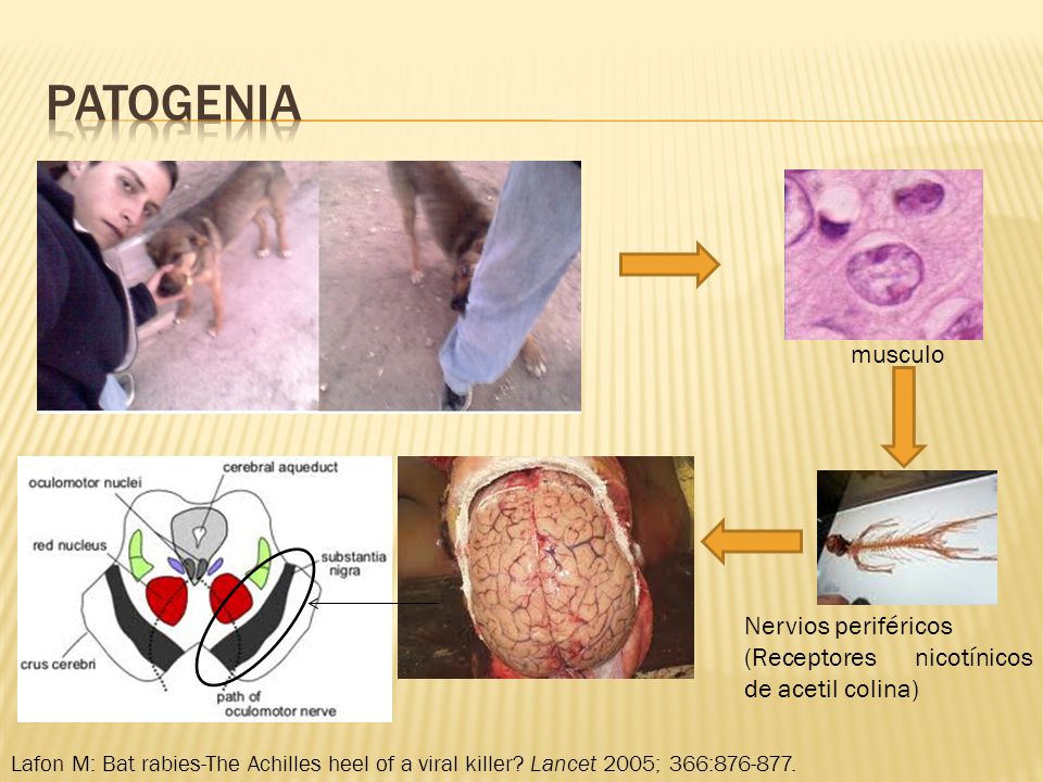 patogenia musculo Nervios periféricos