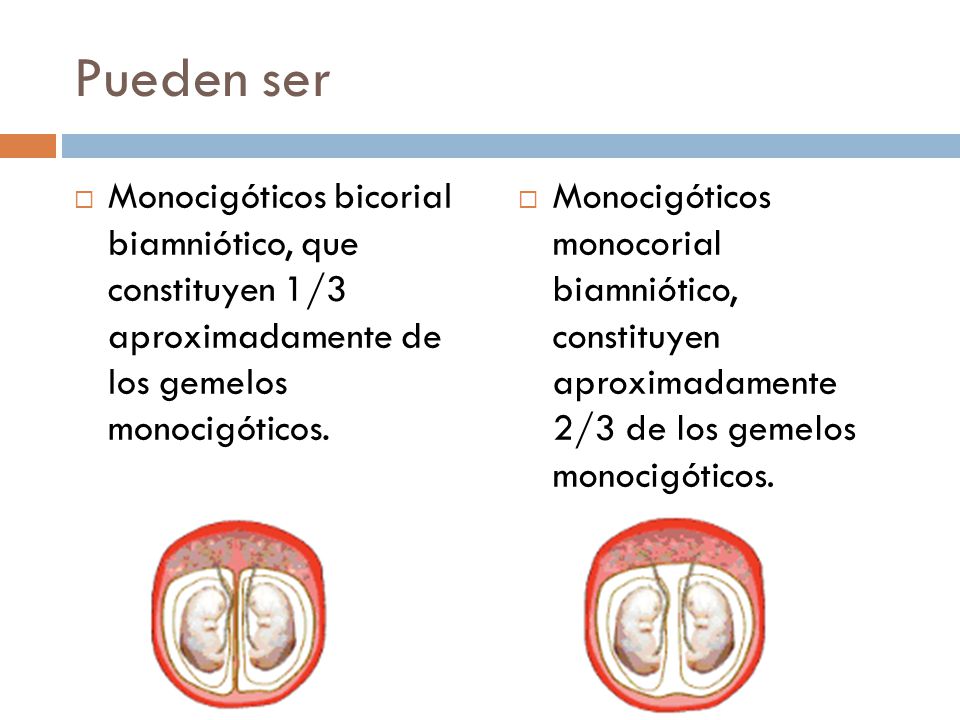Pueden ser Monocigóticos bicorial biamniótico, que constituyen 1/3 aproximadamente de los gemelos monocigóticos.