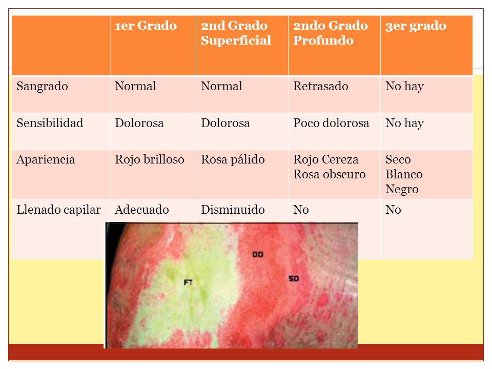 1er Grado 2nd Grado Superficial. 2ndo Grado Profundo. 3er grado. Sangrado. Normal. Retrasado. No hay.