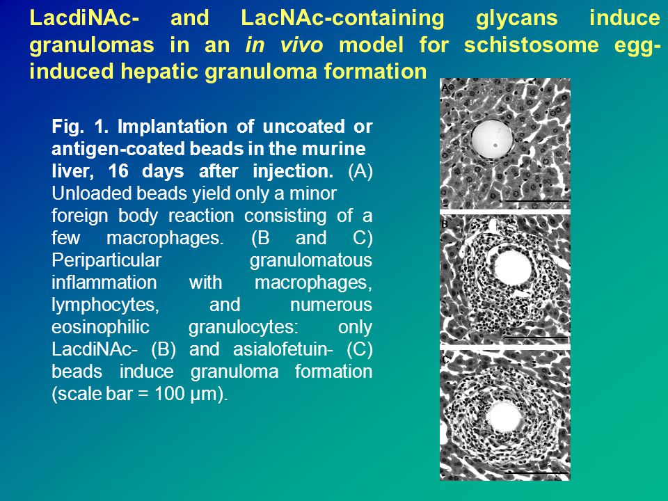 LacdiNAc- and LacNAc-containing glycans induce granulomas in an in vivo model for schistosome egg-induced hepatic granuloma formation